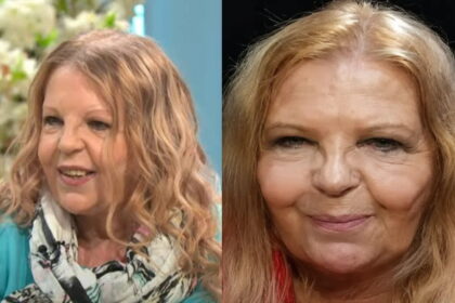Sally Thomsett Face Illness