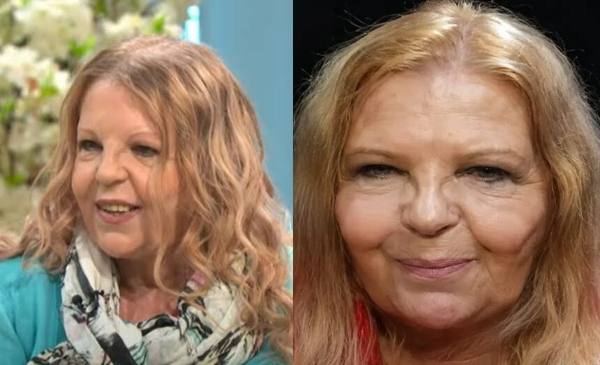 Sally Thomsett Face Illness